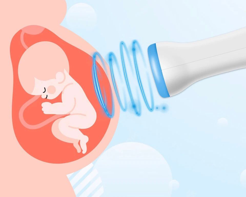 MAGZATI DOPPLER (BABAFIGYELŐ) OTTHONI ULTRAHANG VÁRANDÓS NŐK SZÁMÁRA